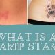 Tramp Stamp Meanings | Old Stamp Collecting Guide: Discover, Value & Preserve Vintage Stamps